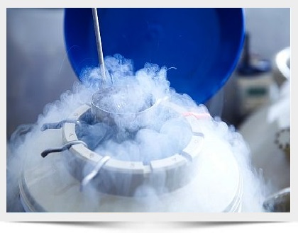 Fertility Preservation in San Diego