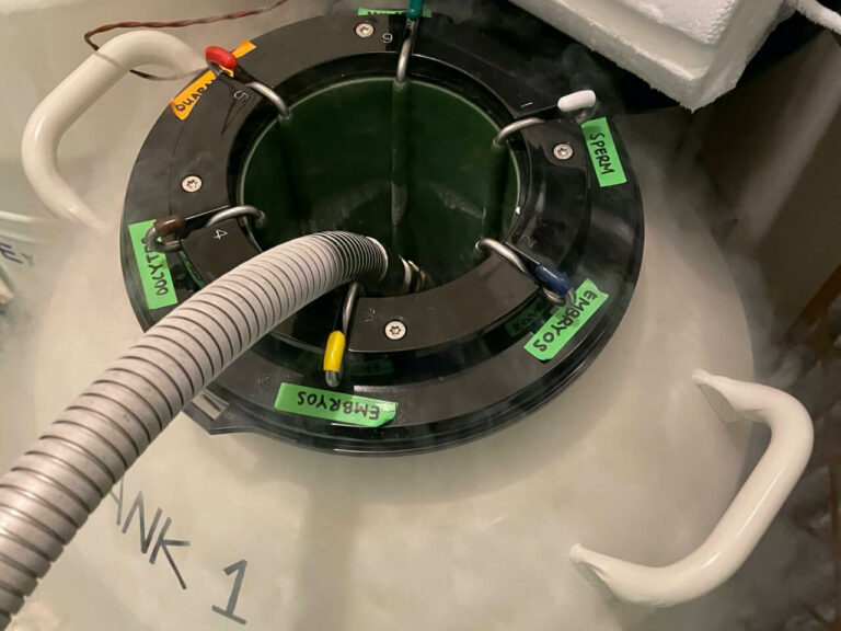 cryopreservation tank San Diego