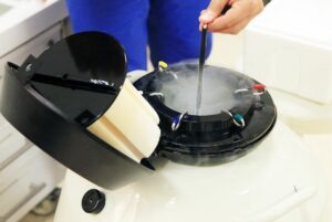 why physicians recommend egg freezing for endometriosis patients