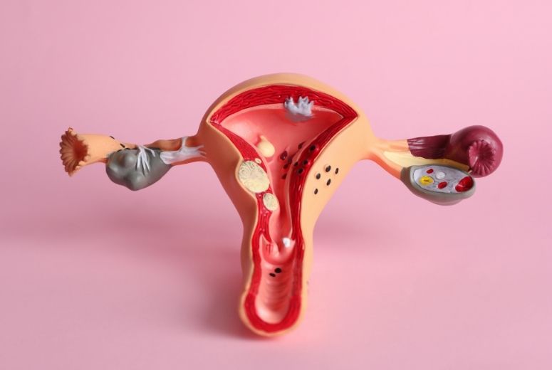 infertility caused by damaged or blocked fallopian tubes